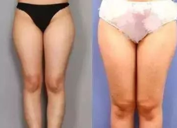 小姐姐大腿内侧按摩图,小姐姐亲身示范